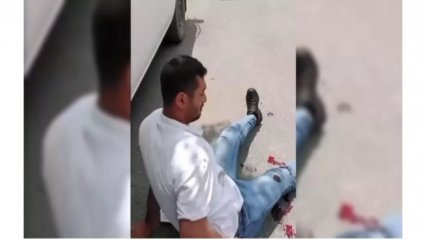 TACİZCİSİNİ VURDU‼️