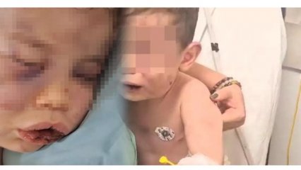 2 YAŞINDAKİ BEBEK DARP EDİLDİ 