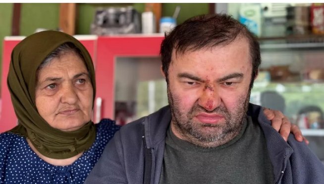 YÜZDE DOKSAN ENGELLİ ADAMA DAYAK ‼️